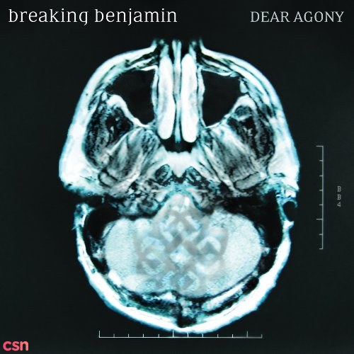 Dear Agony